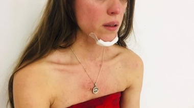 Denuncian una brutal agresión de patovicas en un boliche de La Plata