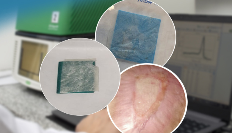 Avance médico histórico: logran cicatrizar por completo una herida compleja con un parche de membrana amniótica