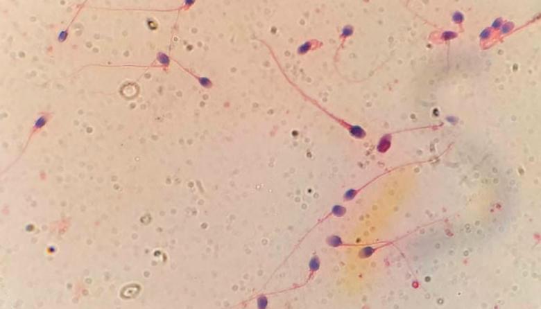 HyperSperm: el desarrollo del CONICET que busca mejorar las tasas de embarazo en fertilización in vitro