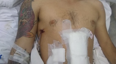 Berisso: denuncian que un patrullero atropelló a dos jóvenes y huyó