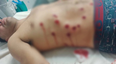 Violencia sindical en la Liga Amateur Platense: un herido y dos partidos suspendidos