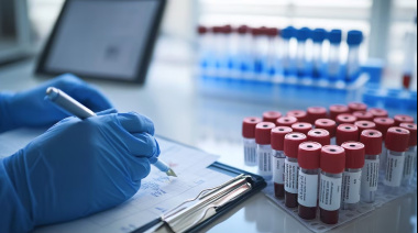 La sífilis crece en Argentina y preocupa a la comunidad médica