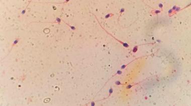HyperSperm: el desarrollo del CONICET que busca mejorar las tasas de embarazo en fertilización in vitro