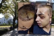Joven fue desfigurado tras ataque en Plaza Moreno y espera cirugía reconstructiva