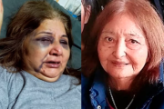 Una mujer sobrevivió a un brutal ataque de su esposo gracias al sacrificio de su madre de 104 años